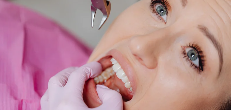 What Happens During Tooth Extraction?