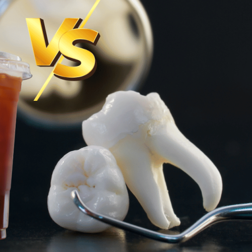 Can I Have Iced Coffee After Tooth Extraction? Post-Tooth Extraction Guide